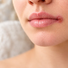 Load image into Gallery viewer, Cold Sore No More